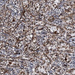 MAGEB1 Antibody, Novus Biologicals:Antibodies:Primary Antibodies